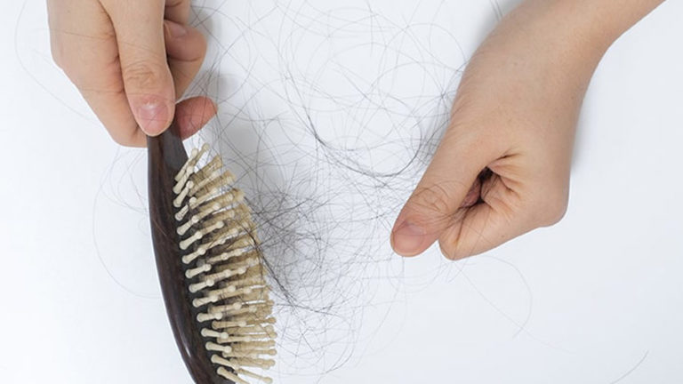 Włosy na szczotce, wypadanie włosów