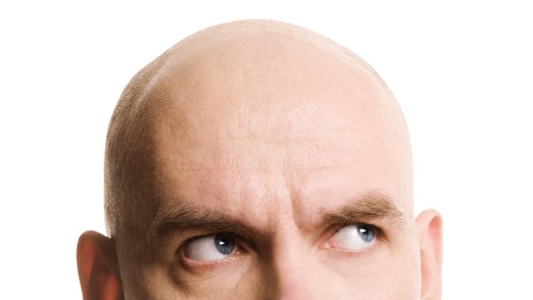 szampon dla łysych, szampon dr bald, pielęgnacja łysej głowy